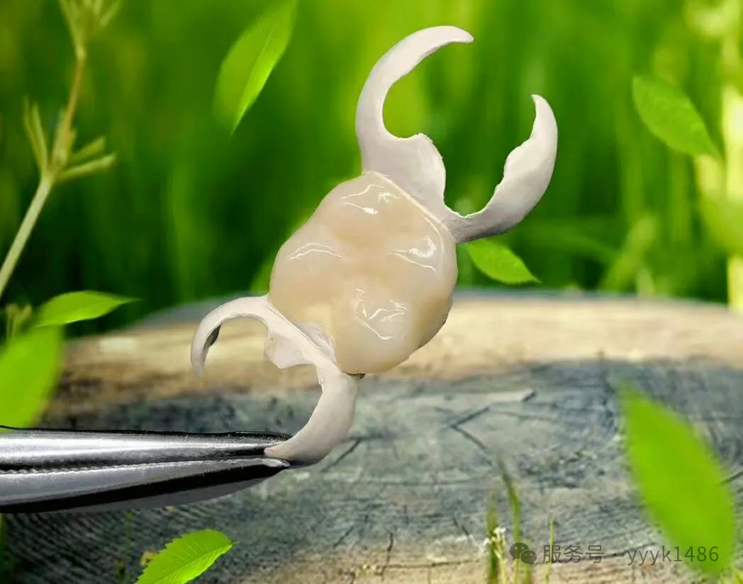 HPP聚合瓷粘接桥—牙齿缺失不想种植牙也不想磨牙的新选择